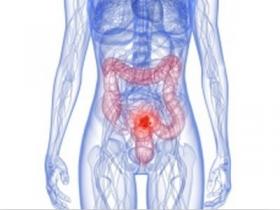 2013年第38届欧洲临床肿瘤协会年会