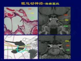 第二届全国神经眼科学术会议
