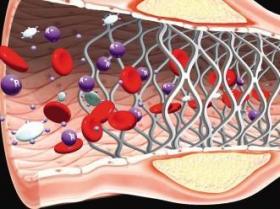 2014年美国心脏协会年会（AHA2014）